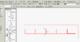 46325_OIC_TEST_1.bmp